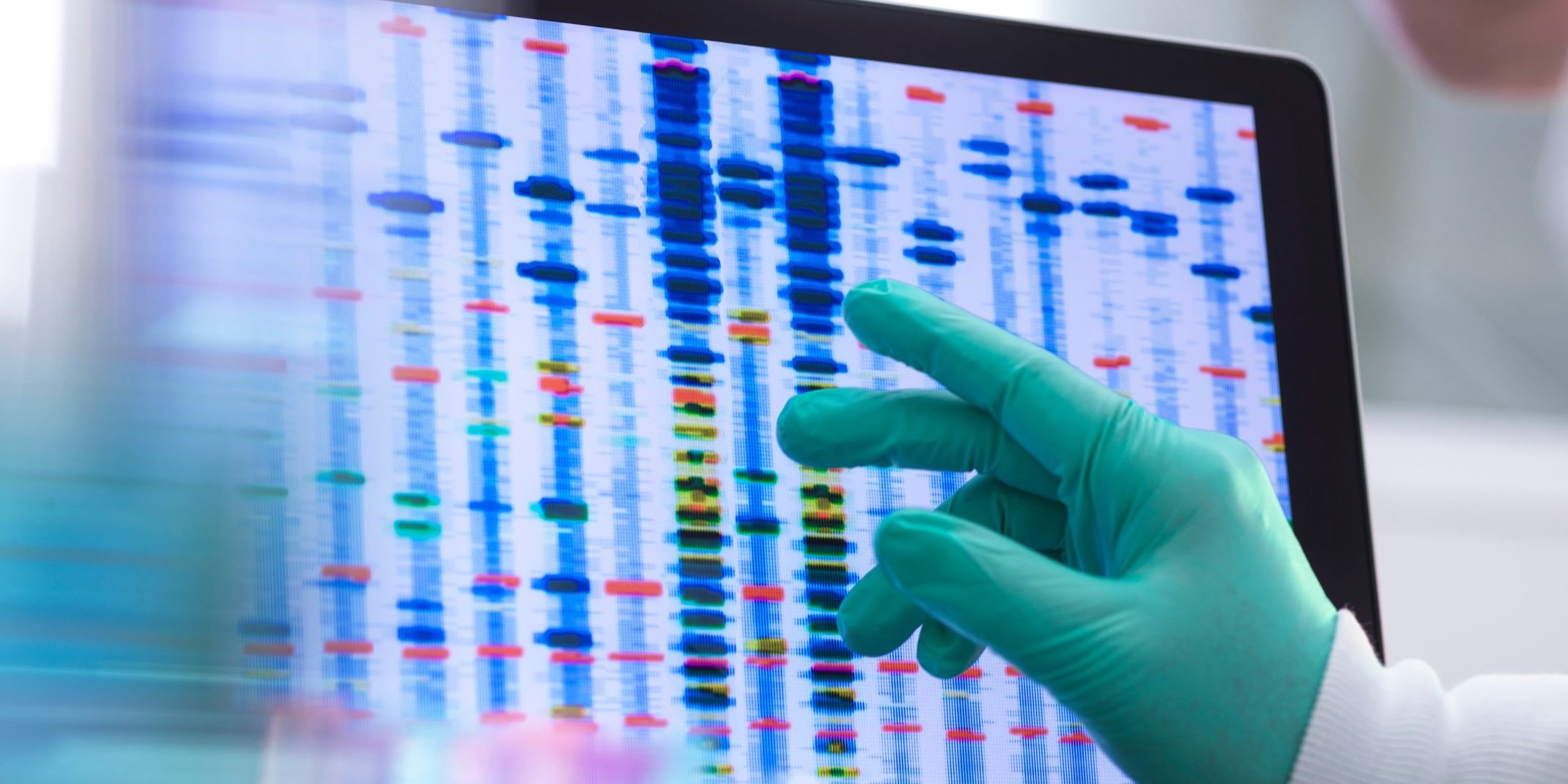 Scientist examining DNA (deoxyribonucleic acid) results on a screen during an experiment in the laboratory.