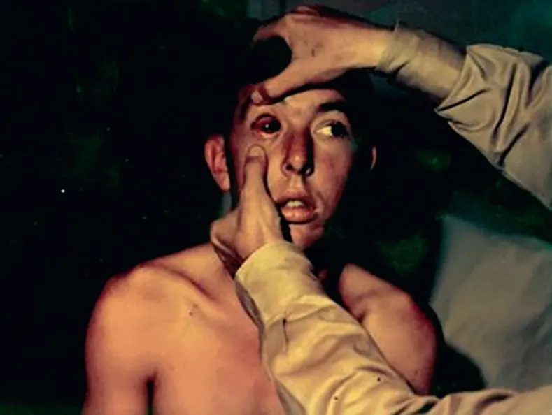 Hantavirus-image-patient