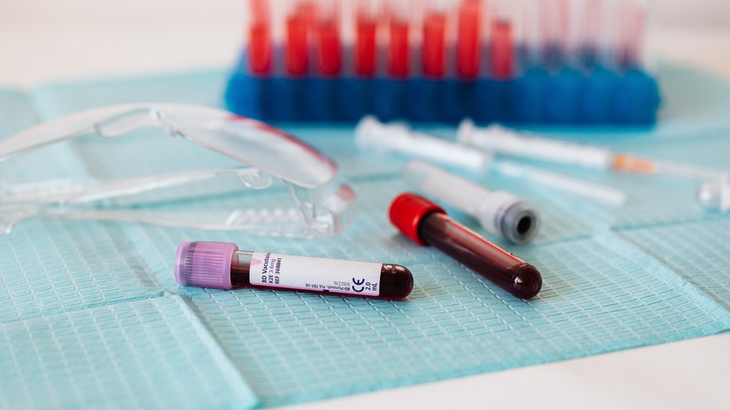 Prøverør med blodprøver, sprøyter og vernebriller på laboratoriebord.