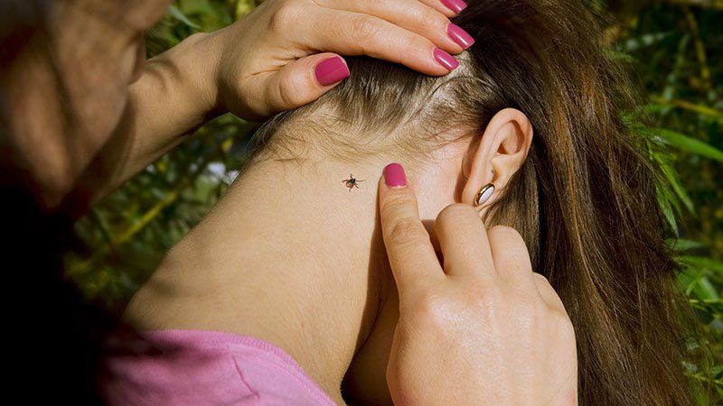 En flått på bakken til en ung jente, voksen dame holder håret til jenta unna og peker på flåtten.