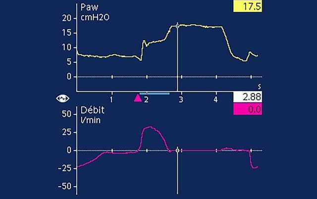 Vol-22_Iss-2_Tip_Figure-1