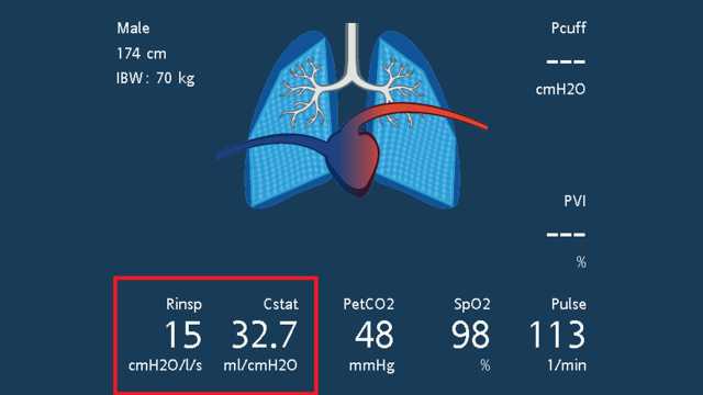 Screenshot showing dynamic lung and values for Rinsp, Cstat, and RCexp