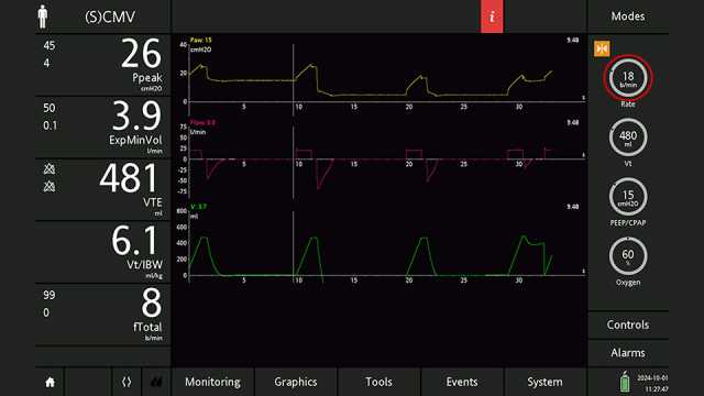 Screenshot showing screen freeze with cursor at beginning of last inspiration before the PEEP change