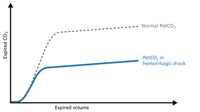 Illustration of PetCo2 during hemorrhagic shock on a volumetric capnogram