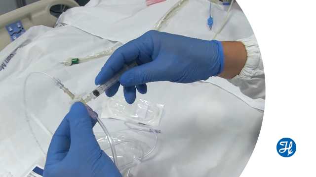 Correct placement of the esophageal balloon or catheter is critical for accurate transpulmonary pressure measurement. In this video, we show the insertion and accurate placement of a Cooper Surgical esophageal balloon catheter on a real ICU patient. 