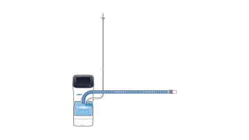 Therapiesystem mit High-Flow Nasenkanüle auf dem HAMILTON-HF90