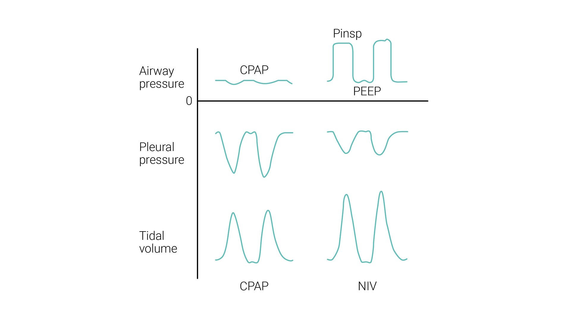 A comprehensive guide to noninvasive ventilation (NIV) | Hamilton