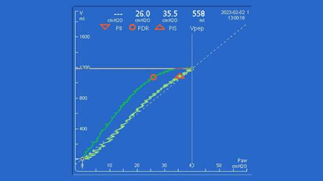 Screenshot of airway PV curve