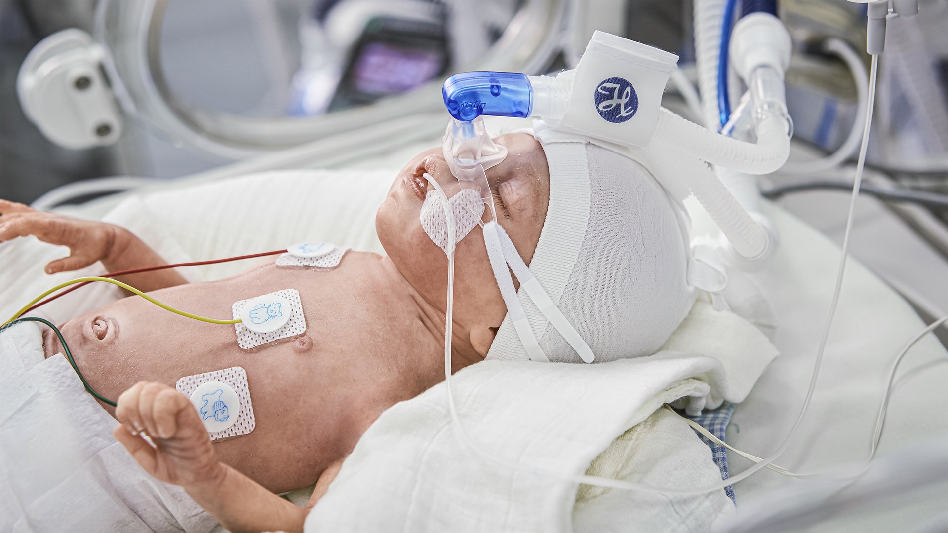 Schlafendes Baby mit nCPAP-Interface