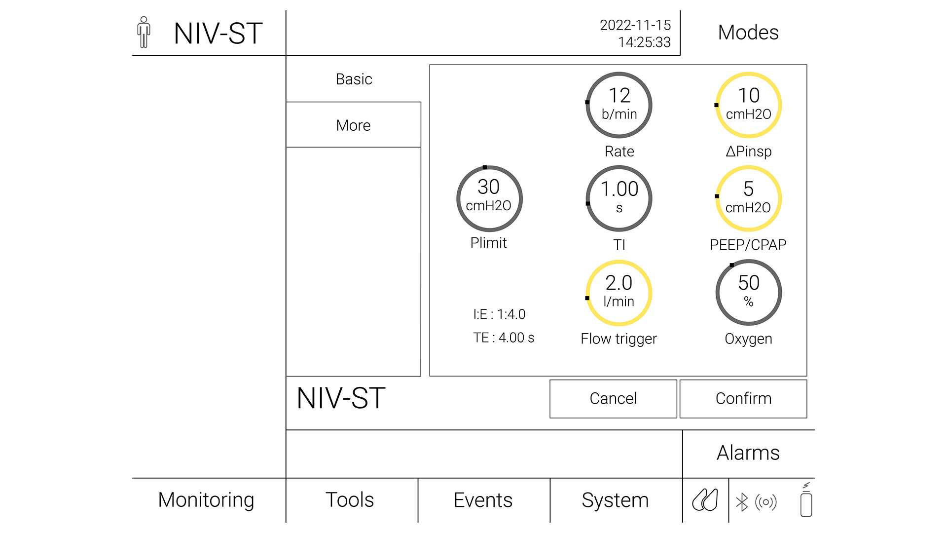 Image of ventilator settings for NIV