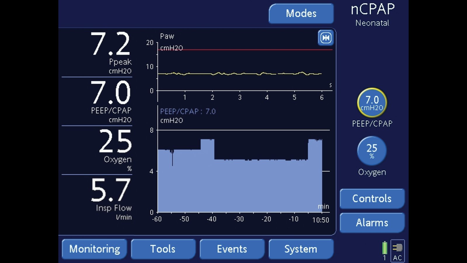 nCPAP-Interface bei unseren Beatmungsgeräten