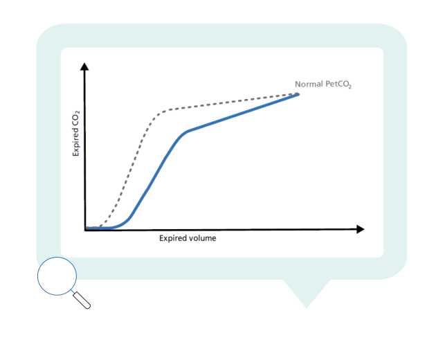 Graph showing normal and actual PetCO2 plotted against expired volume