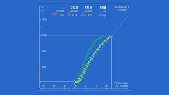 Screenshot of transpulmonary pressure-volume curve