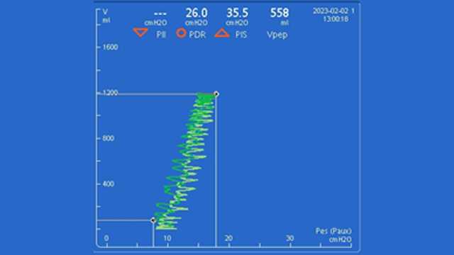 Screenshot of esophageal PV curve