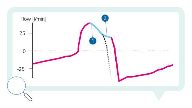 What type of asynchrony can you see? #7