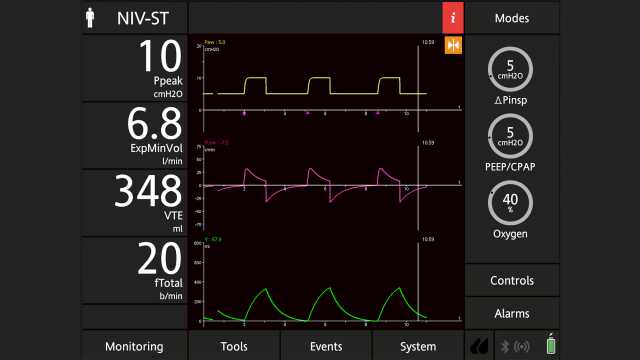 ∆Pinsp setting in NIV-ST