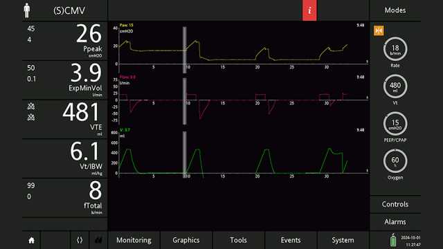 Screenshot showing cursor correctly positioned and Paw of 15