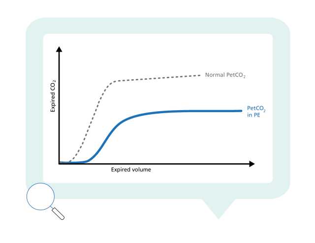 Graph showing normal and actual PetCO2 plotted against expired volume