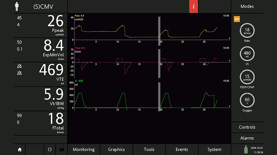 一部SALE中 Breathing-Rページになります＊ Determining the R/I ratio using the single-breath technique