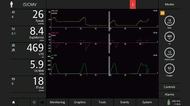 Screenshot showing cursor correctly positioned and corresponding values