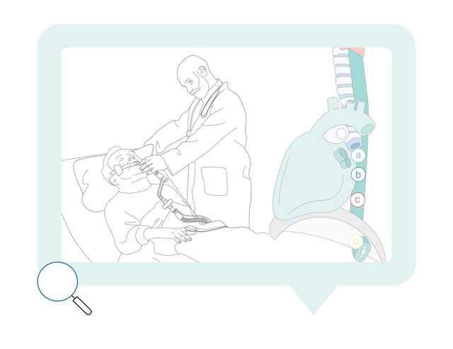 Lineart doctor patient catheter 