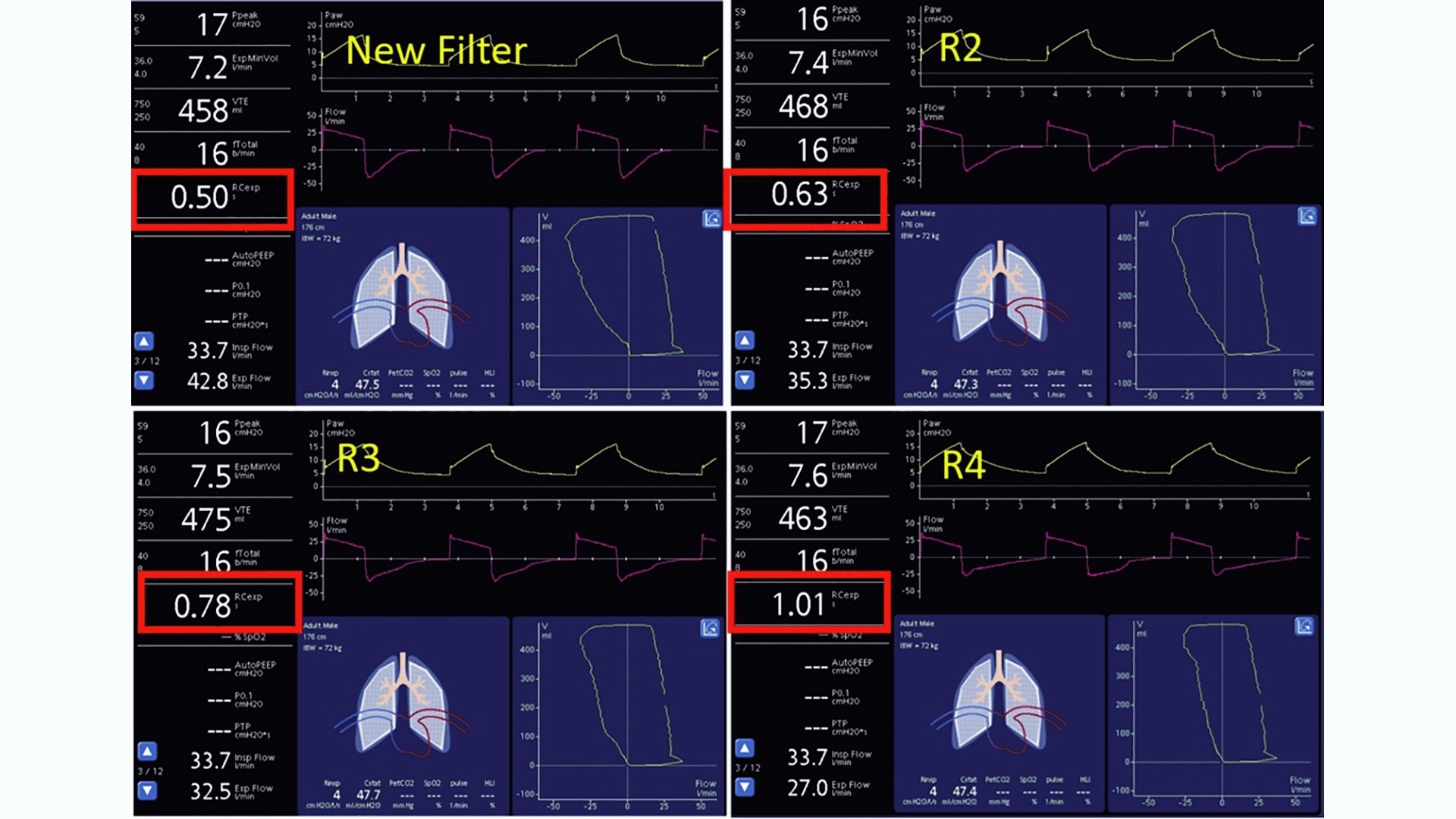 一部SALE中 Breathing-Rページになります＊ How to recognize increases in expiratory filter resistance