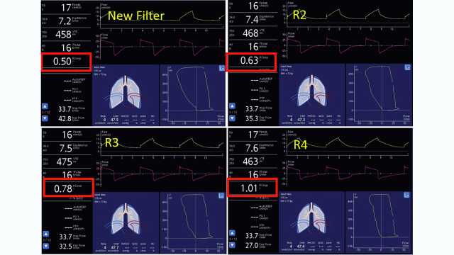 Screenshots showing dynamic lung and monitoring parameters