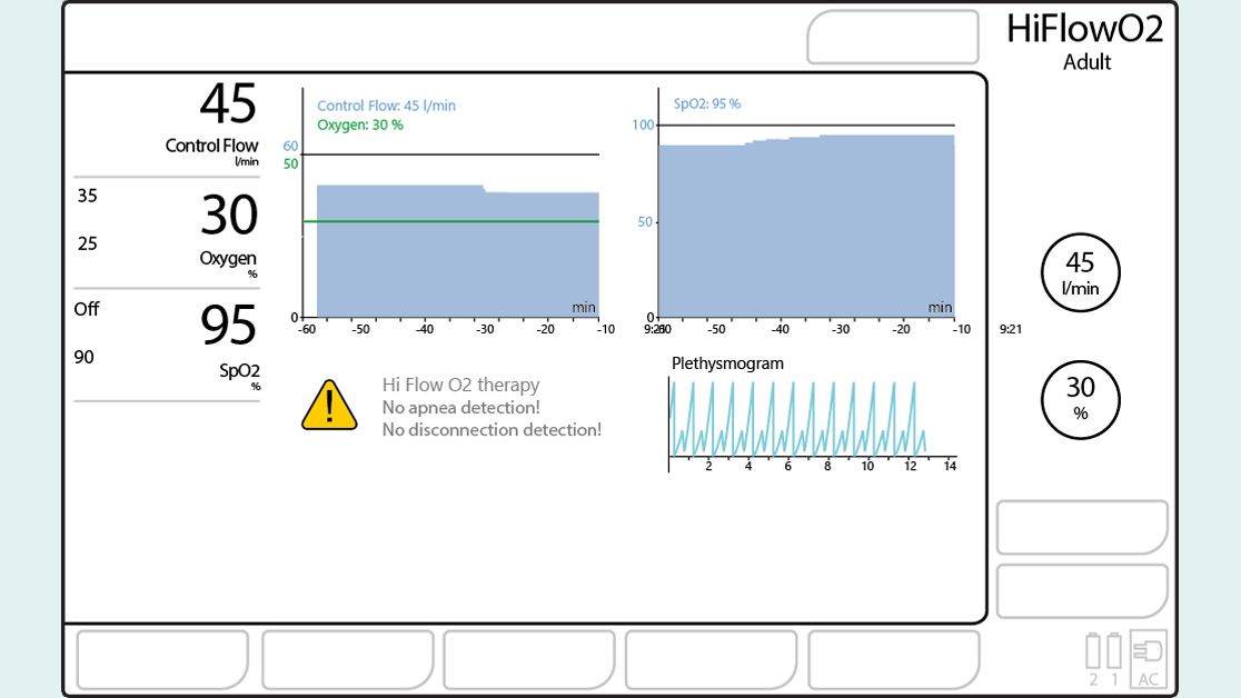 Grafische Darstellung: Anzeige mit Monitoring-Parametern