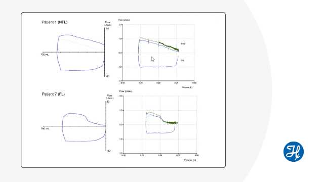Journal Club: Manual compression of abdomen to assess expiratory flow limitation