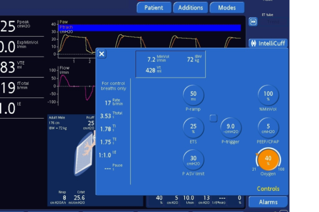 Hamilton Ventilator O2 Sensor Sensors and monitoring for mechanical ventilators | Hamilton Medical