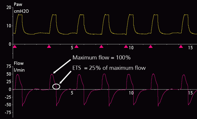 15-1 Tip_Expiratory trigger sensitivity_1