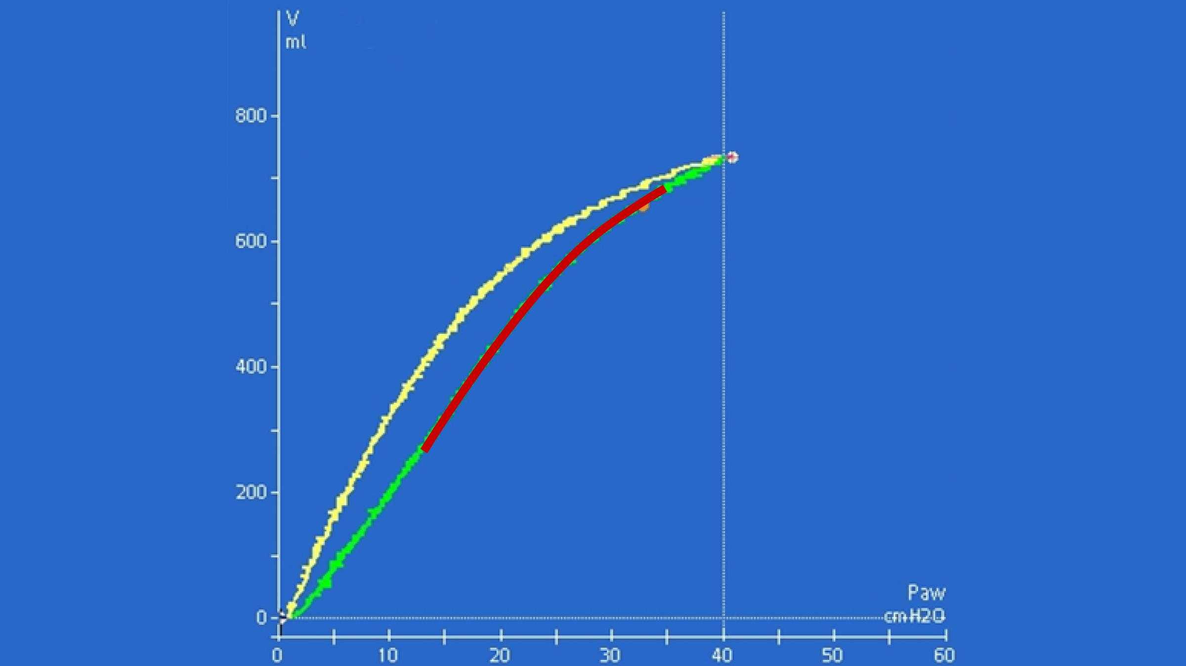 Screenshot showing upward convexity of inspiratory curve