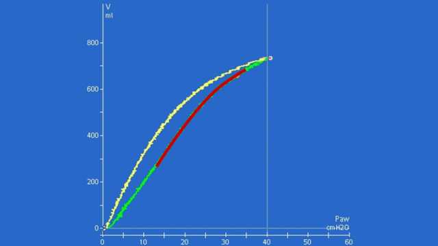 Screenshot showing upward convexity of inspiratory curve