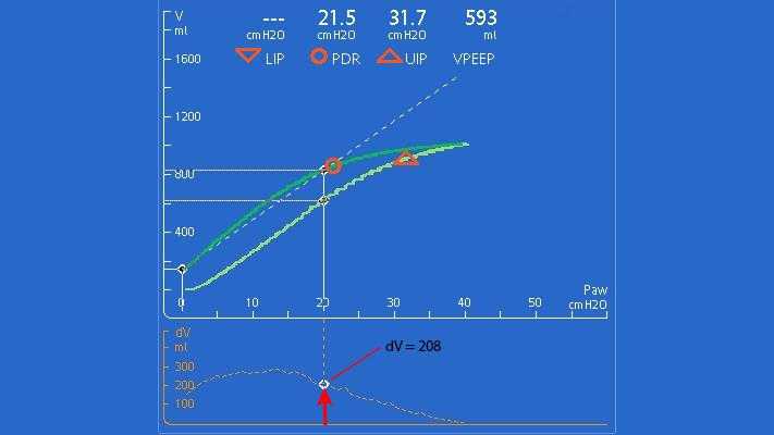 Screenshot showing volume difference at 20cmH20 less than 500 ml