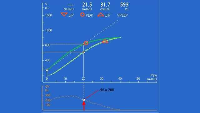 Screenshot showing volume difference at 20cmH20 less than 500 ml