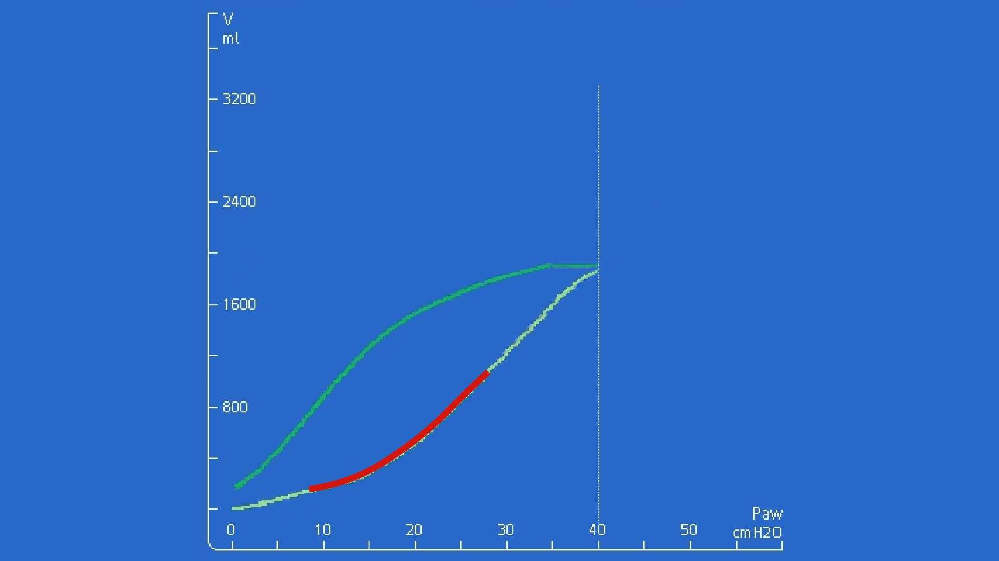 Screenshot showing upward concavity of inspiratory curve