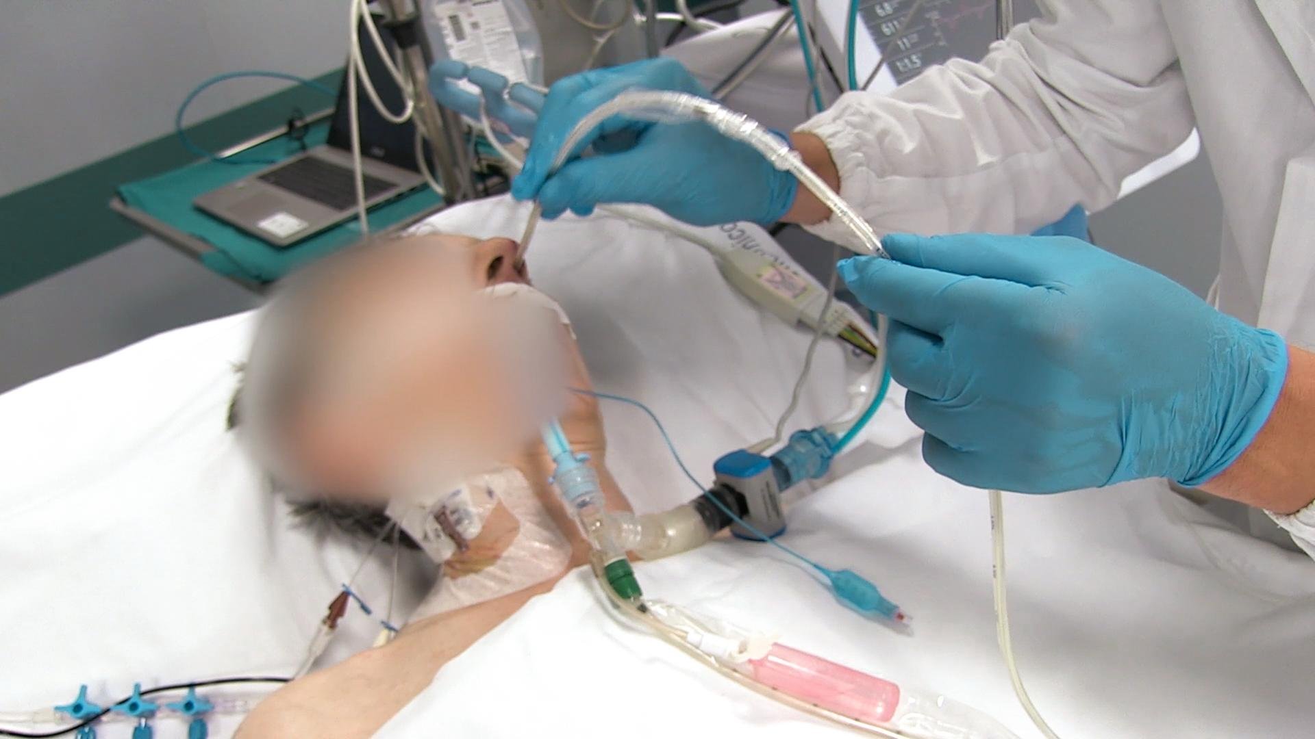 Einführen eines ösophagealen Ballonkatheters in den Patienten