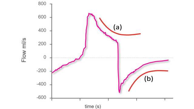 19-2_Tip_Figure_2_Exp_Decay