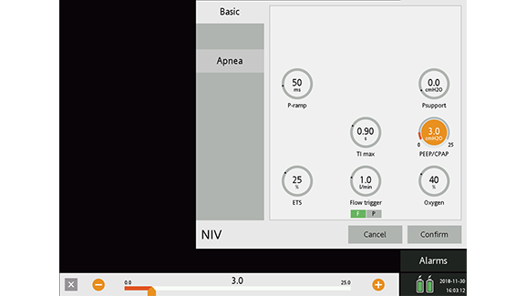 Screenshot showing PEEP setting