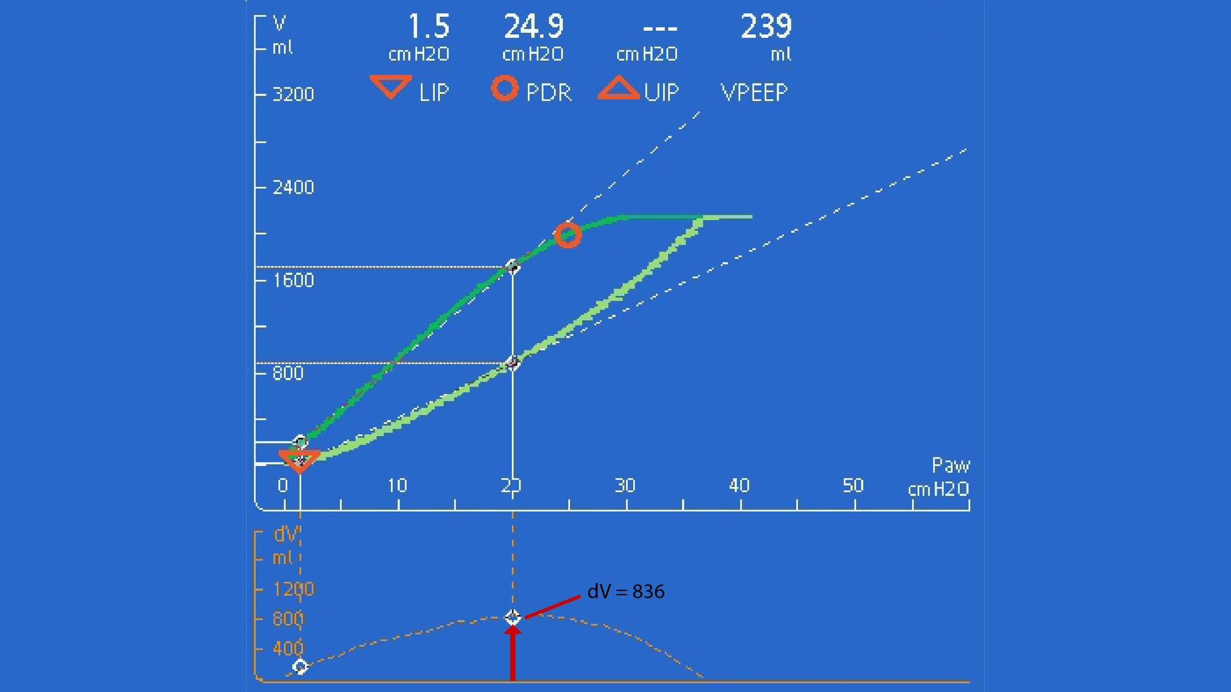 Screenshot showing volume difference at 20cmH20 greater than 500 ml