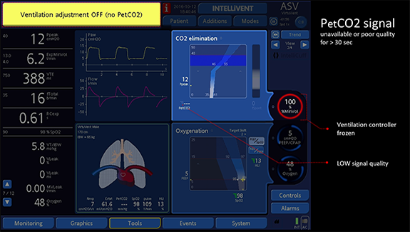 Reliability of SpO2 sensor signal readings