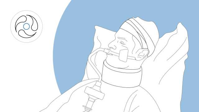 Feature-Module_Clinical-case_Brain-injury_openOlat
