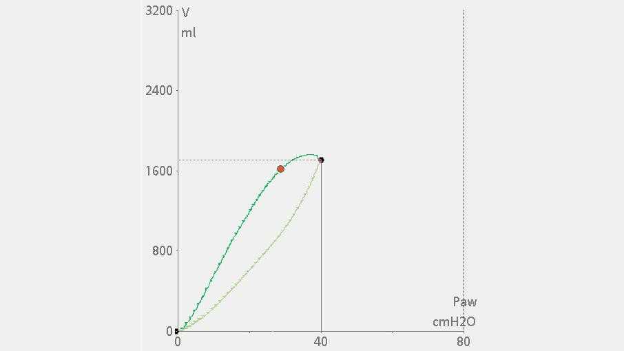 P/V loop showing immediate volume increase