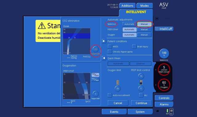 28_Target_Shift_20_Manual_Adjustment_MinVol_ASV