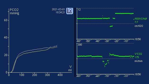 Screenshot mit grafischer Darstellung von PEEP/CPAP im Vergleich zu V’CO2