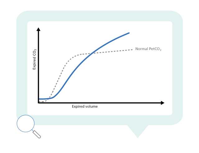 Graph showing normal and actual PetCO2 plotted against expired volume
