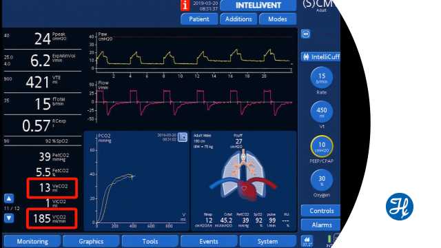Volumetric-Capnography_set-PEEP-according-VCO2_youtube