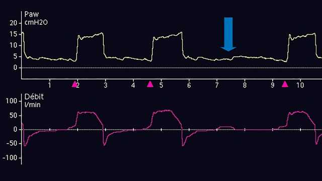 Test your IntelliVence (Vol 16 Issue 3)