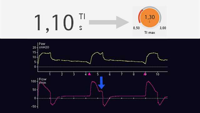 Display showing longer plateau on inspiratory flow