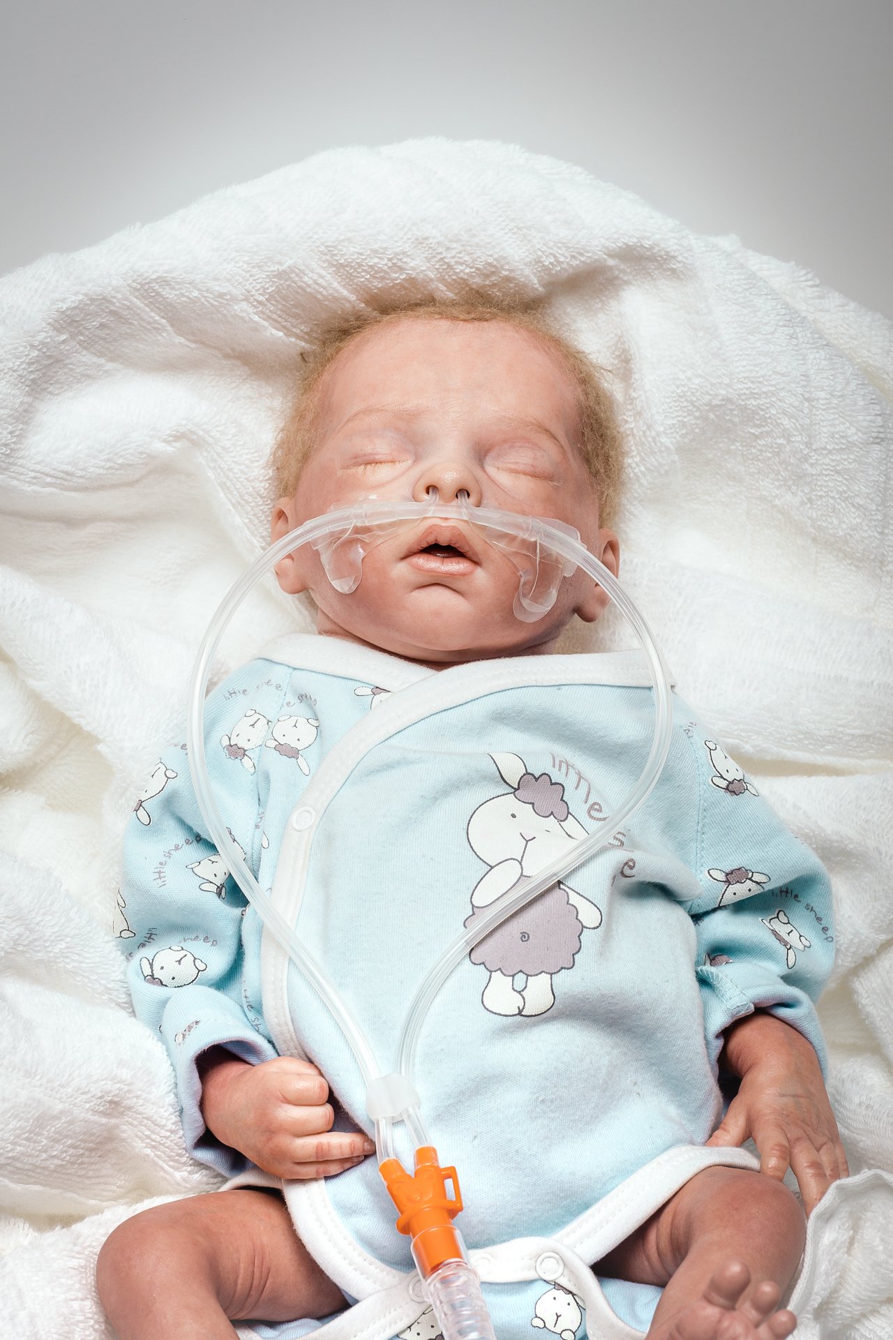 Schlafendes Baby mit Nuflow® Nasenkanüle